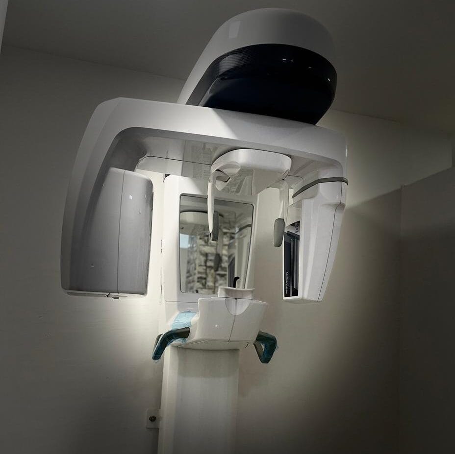 “Full mouth dental X‑ray at Eversmiles Dental Solutions Quthbullapur showing complete teeth and jaw structure”